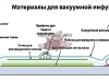 Вакуумная инфузия